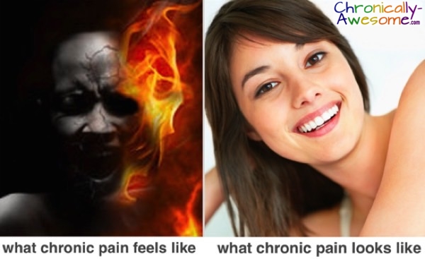 what chronic pain feels like (fire) vs what chronic pain looks like (happy girl)